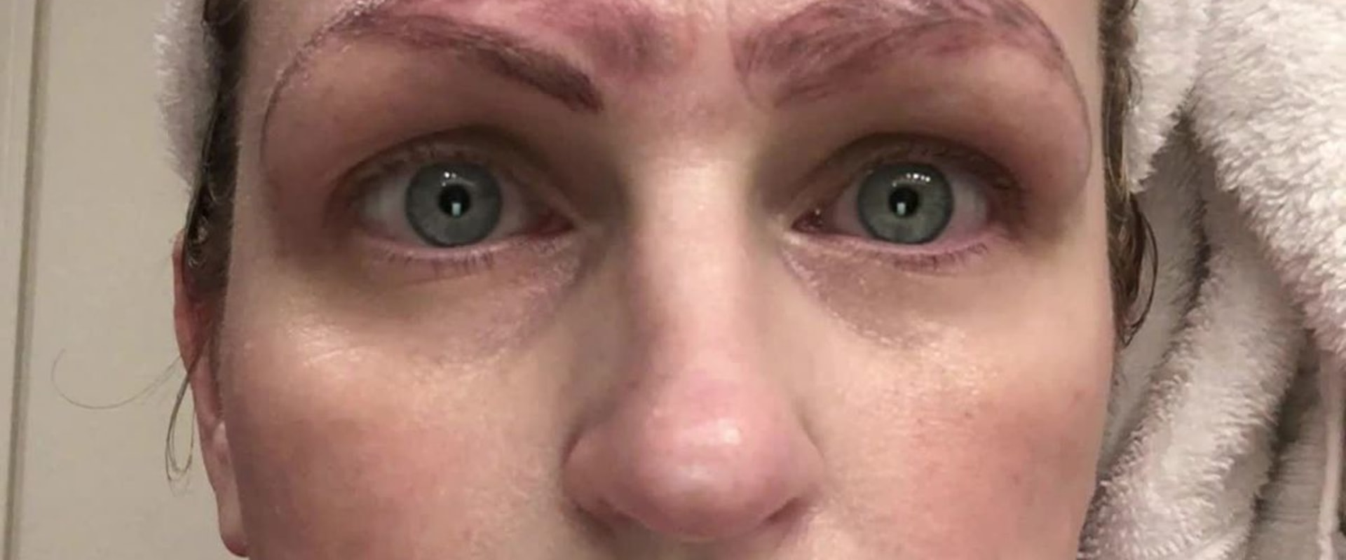 Will microblading be reduced?