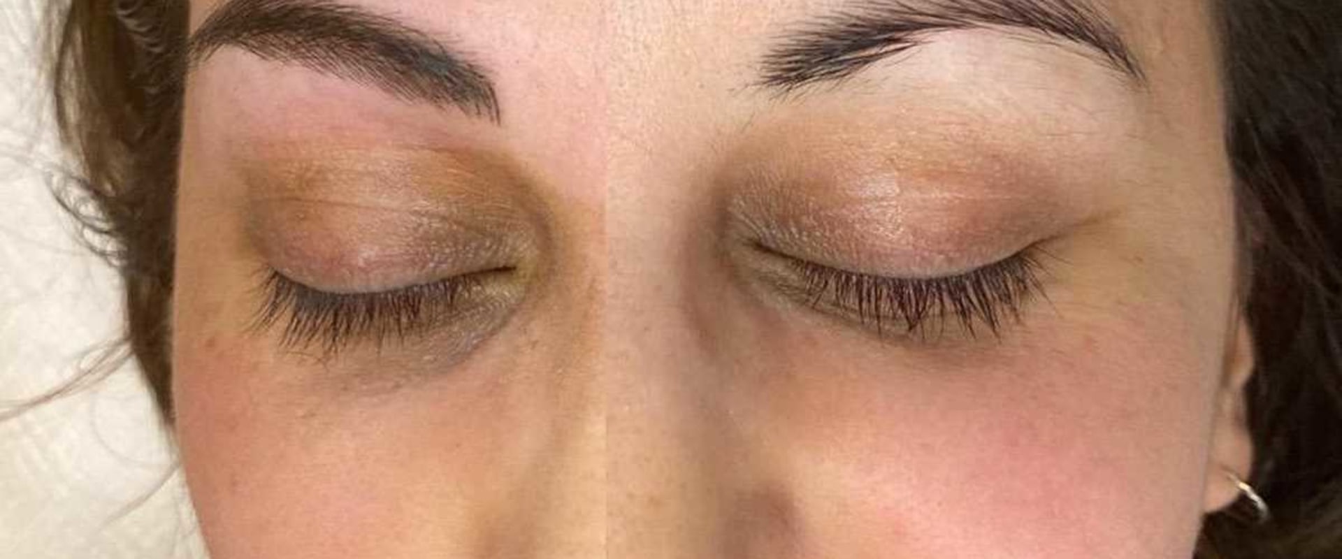 Who should not receive microblading?