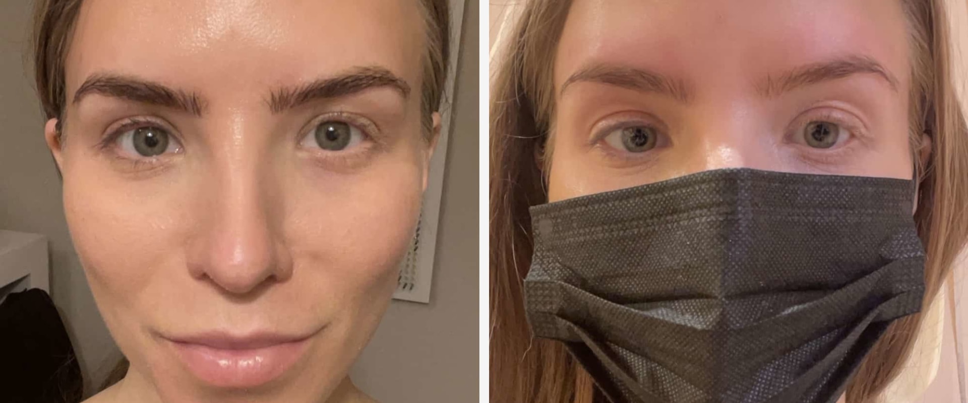 What happens to your real eyebrows after microblading?