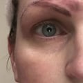 What happens to your eyebrows when you stop using microblading?