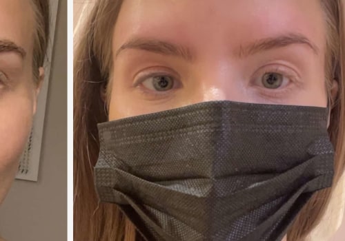 What happens to your real eyebrows after microblading?